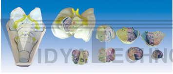 The model of brainstem transection